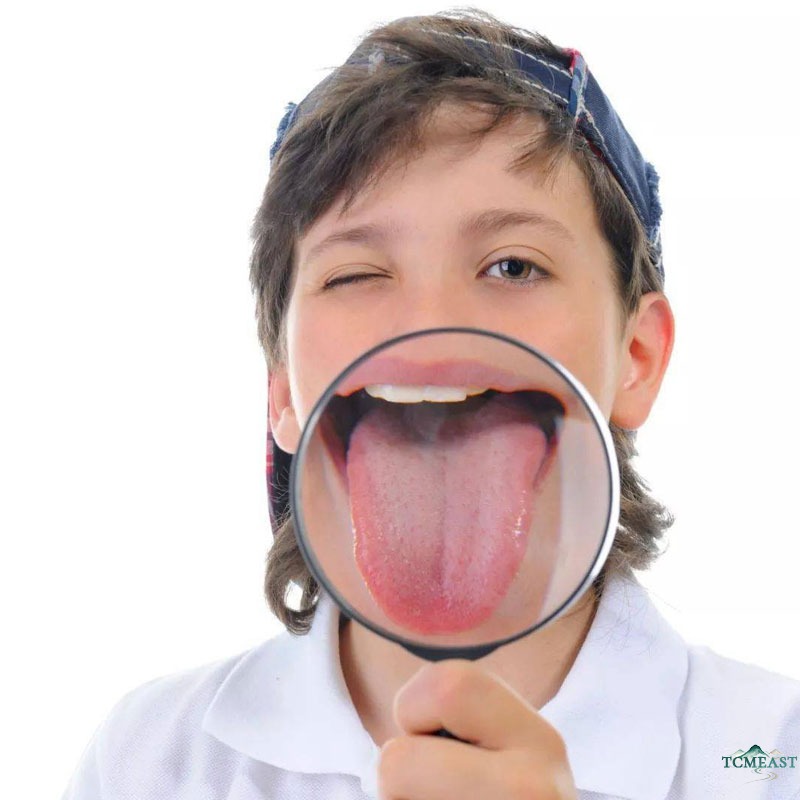 Tongue Diagnosis: A Beginner's Guide to Reading Your Own Tongue
